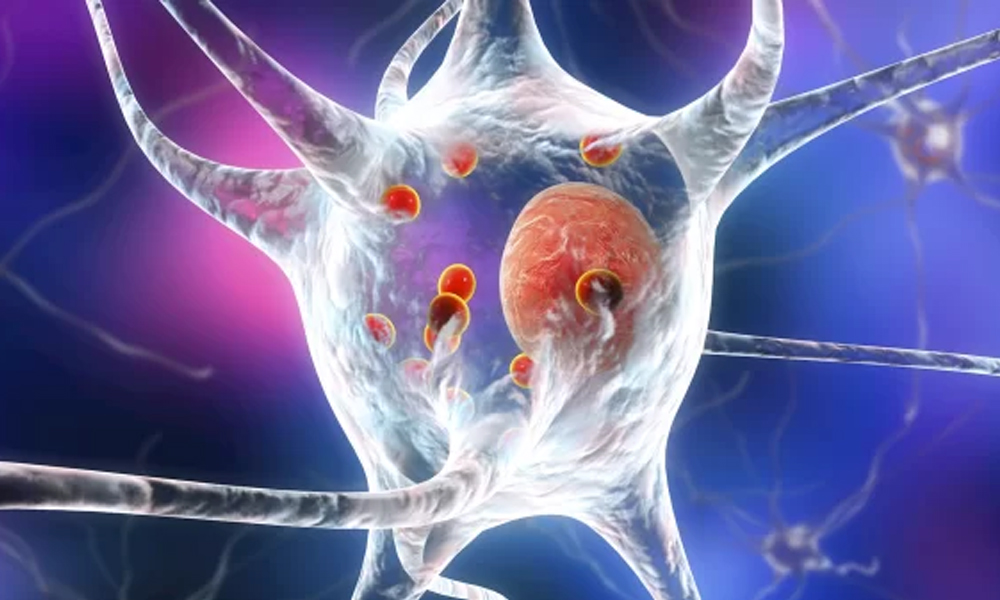 karaciger metastaz 2