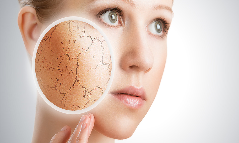 Что такое зоб щитовидной железы?