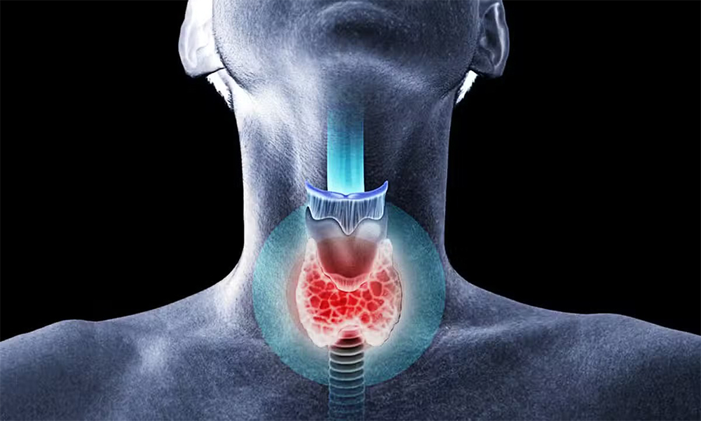 Что такое узел щитовидной железы?